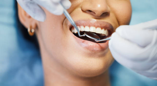 Best Knocked-Out Tooth Emergency  in Crestline, OH