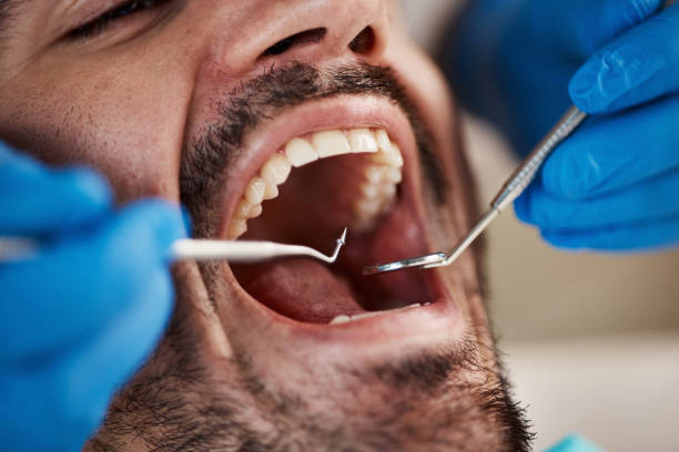 Best Dentist for Tooth Abscess  in Crestline, OH